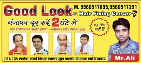 Best Non-Surgical Hair Fixing In Ghaziabad Jan 2024