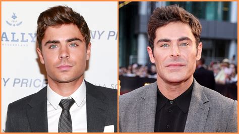 Here’s What Zac Efron Looked Like Before and After His Accident