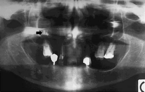 Orthopantomography. | Download Scientific Diagram