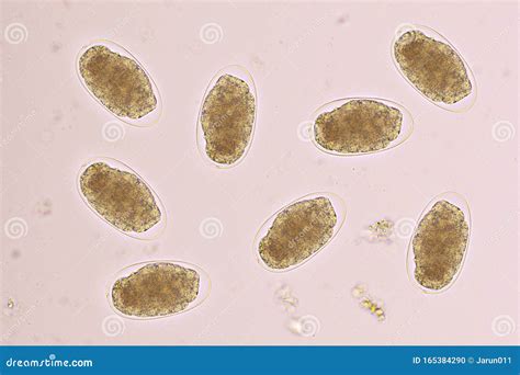 Bacterial Infection Causing Yellow Stool - BEST HOME DESIGN IDEAS