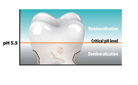 How to remineralize teeth | News | Dentagama