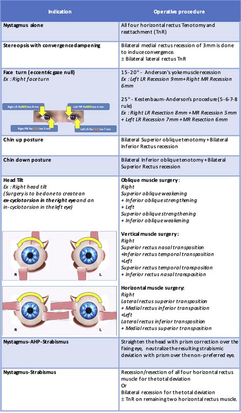 Ten Tips for Management of Nystagmus