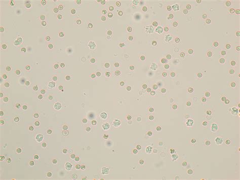 What Causes White Blood Cells In Dog Urine