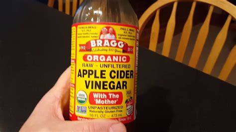 Apple cider vinegar for kidney stones. - YouTube