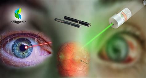 laser pointer causes permanent eye damage Archives | DailyPedia