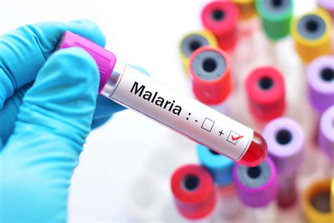 Overview of Malaria: Symptoms, Complications and Diagnosis