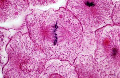 Metaphase Of Mitosis