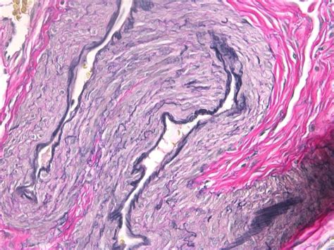 Uterus Histology Labeled