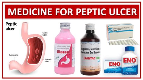 Peptic Ulcer Disease Peptic Ulcer Medications Nursing Ulcers | My XXX ...