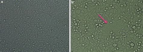 No syncytia recognized in the cells transfected individually with... | Download Scientific Diagram