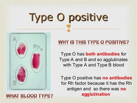 Survey of Anatomy and Physiology Chap 12 Part Two