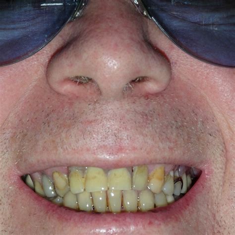 My Yellow Teeth Free Stock Photo - Public Domain Pictures