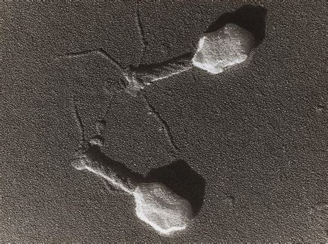 Image of a virus taken by an electron microscope | Page 5 | O-T Lounge