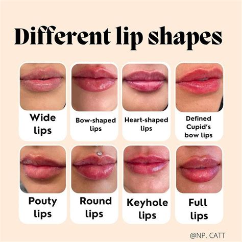 Different Lip Filler Shapes in 2022 | Lip fillers, Lip shapes, Lips