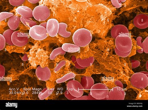 colorized scanning electron microscope image of a blood clot Stock Photo, Royalty Free Image ...