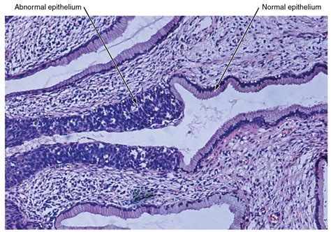 Types of Tissues | Anatomy and Physiology I