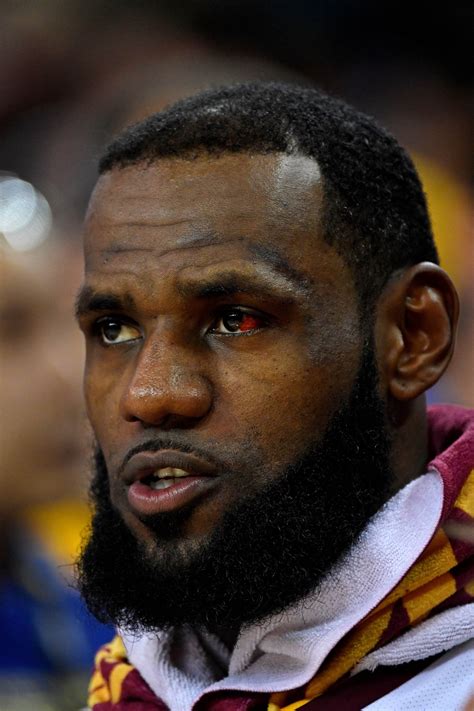 LeBron James' eye is still freaky, and fans can't stop talking about it