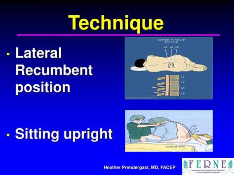 PPT - Lumbar Puncture: Indications and Procedure PowerPoint Presentation - ID:1411264