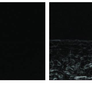 The extraction effect of the traditional Sobel edge detection... | Download Scientific Diagram