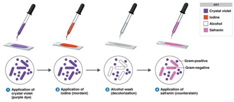 Gram Staining | Principle | Procedure and Results