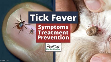 Tick Fever: Symptoms, Treatment, Prevention | By Dr. Anirudh Mittal ...