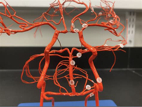 Diagram of Circle of Willis Model | Quizlet