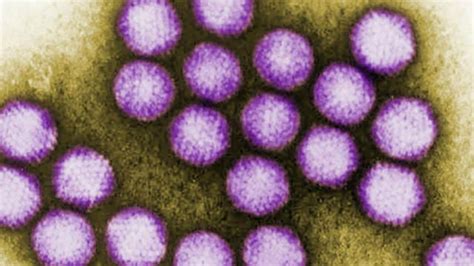 Adenovirus Outbreak Kills 6 Children At N.J. Health Facility