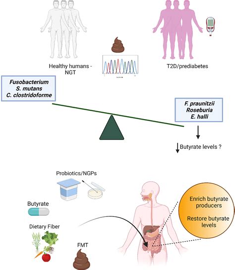 Frontiers | Therapeutic Potential of Butyrate for Treatment of Type 2 Diabetes