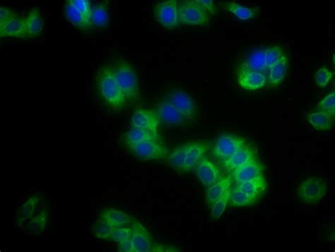 Anti-HLA-B Antibodies | Invitrogen