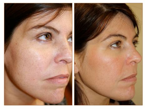 Pictures Obagi skin care Orlando, Pictures Obagi skin care Clermont ...