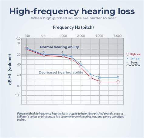 High-frequency hearing loss: What is it and how is it treated?