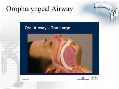 Oral Airway Sizing Chart