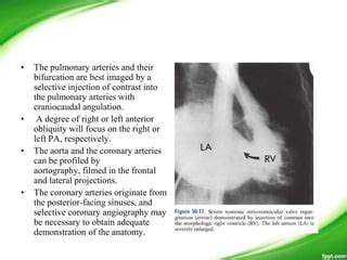 L tga anatomy, management- | PPT