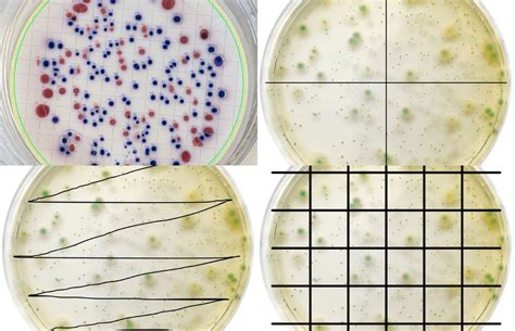 How to Count Colonies on Agar Plates: A Complete Guide