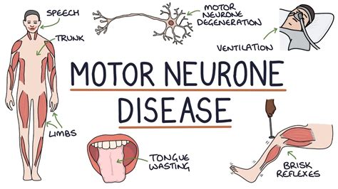 Motor Neuron Disease (MND) : Causes, Symptoms, Treatment