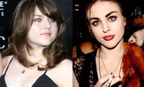 Frances Bean Cobain Nose Job Plastic Surgery Before and After | Celebie