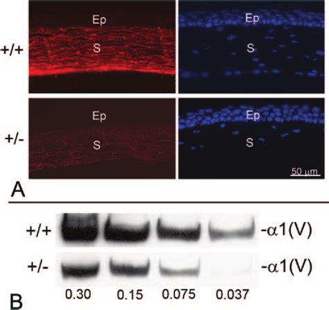 (A) Type V collagen was localized in wild-type (/) and... | Download Scientific Diagram