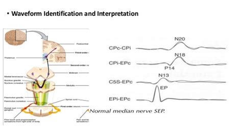 Somatosensory evoked potential