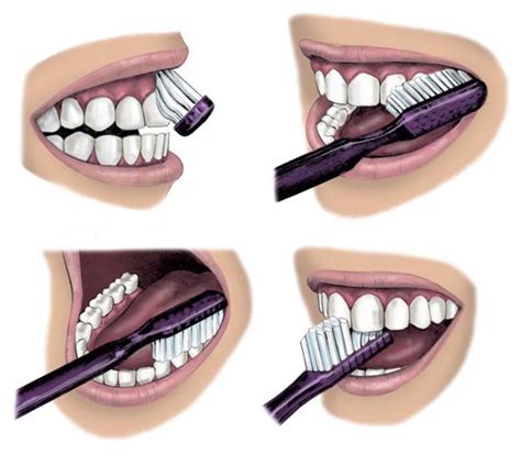 How to brush your teeth correctly - Oakwood Dental Clinic