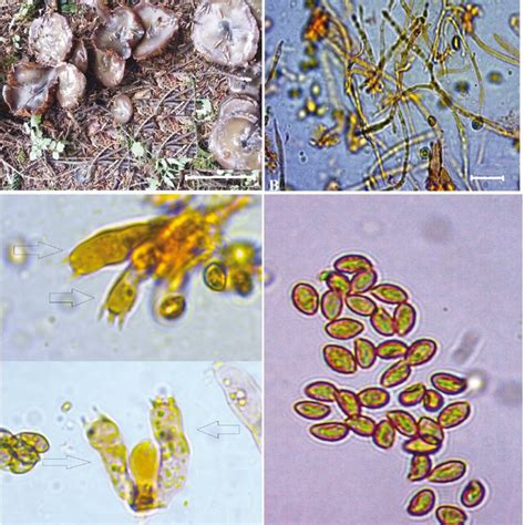 Hygrophoropsis morganii : A- basidiomes, B- pileipellis, C- basidia, D-... | Download Scientific ...