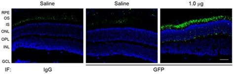 Immunofluorescence labeling using anti-GFP was performed on ...