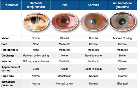 Diabetes And Red Eyes - Effective Health