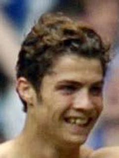 ronaldo teeth - Cristiano Ronaldo Photo (12289842) - Fanpop