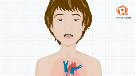 What are the signs of malnutrition?