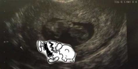 Funny Things Detected by Ultrasound (20 photos) | KLYKER.COM