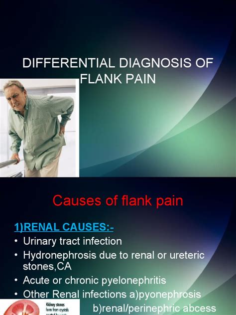 Differential Diagnosis of Flank Pain