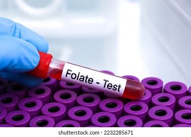 Folate Test Look Abnormalities Blood Blood Stock Photo 2232285671 | Shutterstock