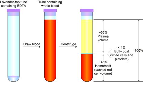 Platelet Count - High & Low Platelet Count, Causes & Treatment