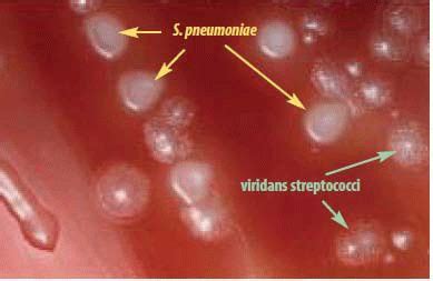 Streptococcus pneumoniae colonies | Medical Laboratories