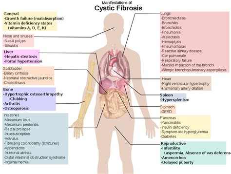 Cystic fibrosis physician - Cancer Therapy Advisor